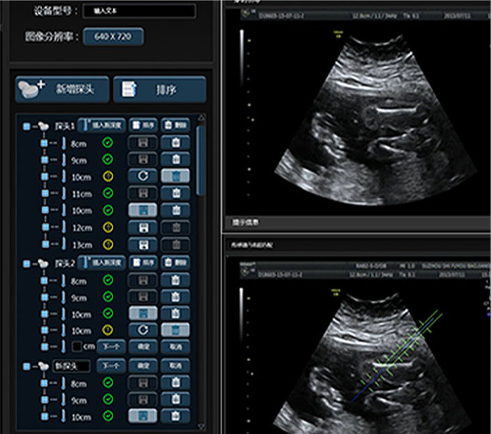 武漢睿影醫(yī)療科技超聲系統(tǒng)軟件界面設計